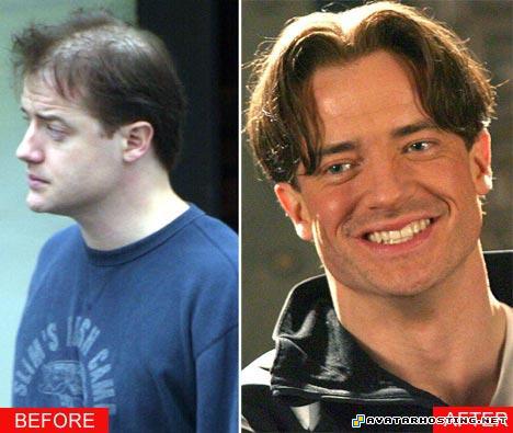 photographyphotography frasersplit_468x395